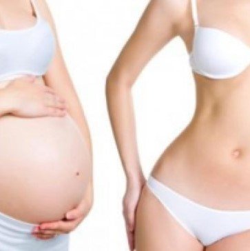 Schwangerschaft nach einer Bauchdeckenstraffung